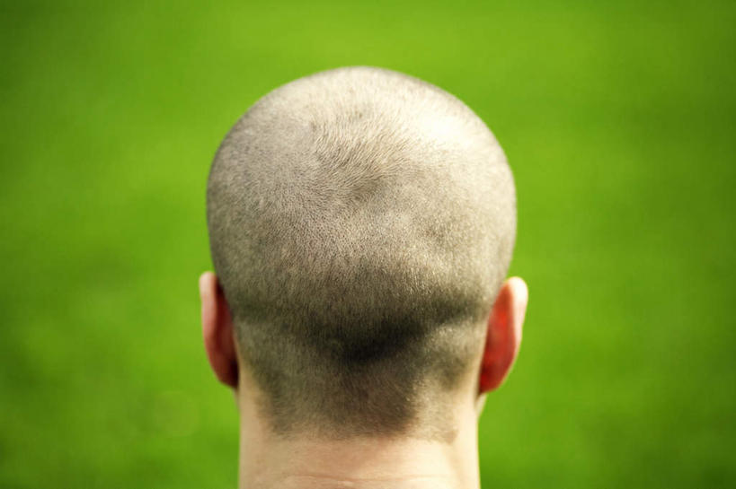 西方人,脸,头,脸颊,秃头,一个人,站,横图,室外,特写,白天,草地,草坪,植物,欧洲,欧洲人,仅一个男性,仅一个人,仅一个中年男性,阴影,模糊,光线,影子,草,背面,绿色,阳光,站着,后脑,含糊,恍惚,模胡,依稀,隐约,男人,男性,中年男性,白种人,头部,光头,无发,脸部,脸蛋,面部,站立,半身,彩图