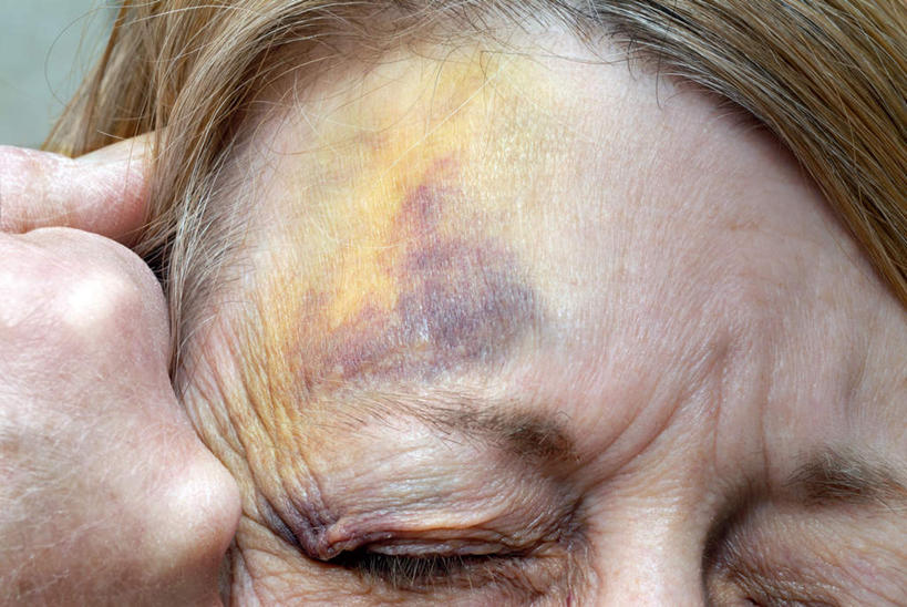 西方人,手,头发,一个人,站,投,举,闭眼,横图,俯视,室内,特写,白天,房间,欧洲,欧洲人,仅一个女性,仅一个人,阴影,光线,影子,灯光,一个,黄色,托,站着,仅一个中年女性,手部,单个,暴力,家庭暴力,家暴,女人,女性,中年女性,白种人,闭眼睛,闭着眼,闭着眼睛,举起,举手,举着,抛,扔,撒,向上举,向上伸,向上托,站立,掷,半身,彩图,高角度拍摄