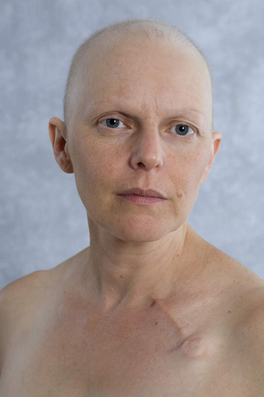 西方人,秃头,一个人,竖图,室内,白天,白色背景,正面,欧洲,欧洲人,仅一个年轻女性,仅一个女性,仅一个人,裸露,摄影,影棚,裸,年轻女性,女人,女性,白种人,光头,无发,半身,彩图,影棚拍摄,拍摄