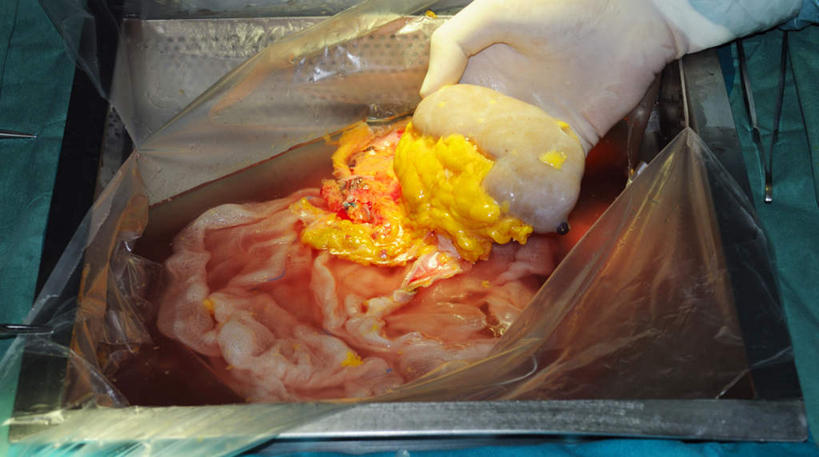 西方人,手,内脏,肠,肾脏,动脉,静脉,十二指肠,一个人,横图,俯视,室内,白天,静物,欧洲,欧洲人,仅一个男性,仅一个人,握,阴影,光线,医学,影子,塑胶,灯光,拿,拿着,仅一个年轻男性,模型,手部,握着,人体,生物学,人体器官,解剖,器官,生理学,男人,男性,年轻男性,白种人,大肠,盲肠,小肠,直肠,半身,彩图,高角度拍摄,剖解