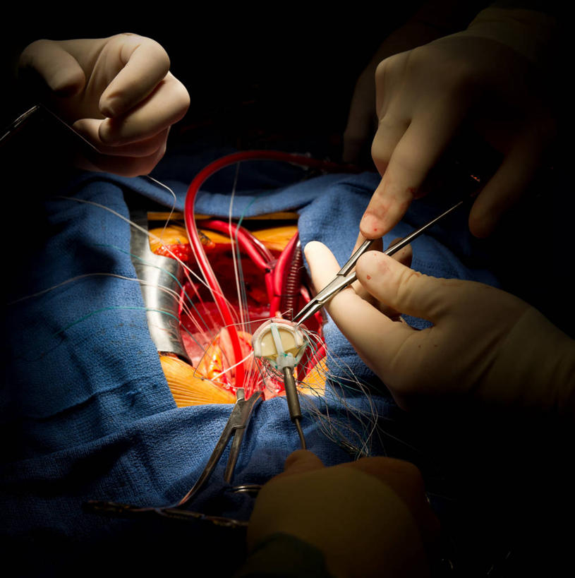 西方人,手,两个人,同事,医生,竖图,俯视,室内,特写,白天,成功,合作,团队,集体,信心,床,金属制品,欧洲,欧洲人,双手,握,修剪,金属,工具,管子,剪刀,线,拿,拿着,管道,队伍,手套,医护人员,医疗人员,手部,橡胶,握着,裁剪,医疗设备,剪子,领导,剪裁,切割,成就,医疗器械,橡胶手套,手术台,合伙,领袖,橡胶制品,手术床,医用手套,手术剪刀,手术剪,男人,男性,中年男性,白种人,大夫,半身,彩图,高角度拍摄