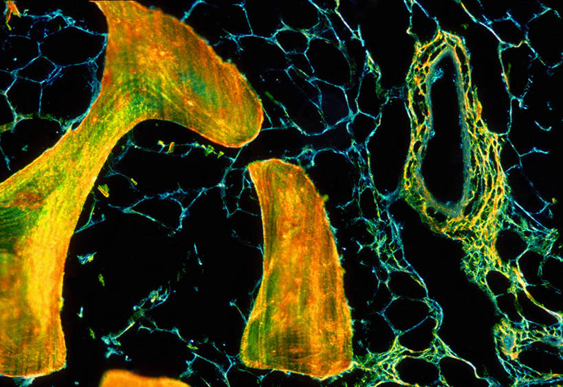 骨骼,无人,横图,室内,特写,白天,正面,微距,仪器,微生物,阴影,检查,反射,分析,科学,医学,纹路,纹理,细胞,显微镜,影子,骨头,绿色,观察,脂肪,金色,清晰,探索,放大,观看,仔细,透镜,骨架,生物学,凸透镜,富贵,聚焦,关注,骨髓,忠诚,肌理,光学,清楚,富丽,名誉,荣华,显微图片,彩图,微距摄影