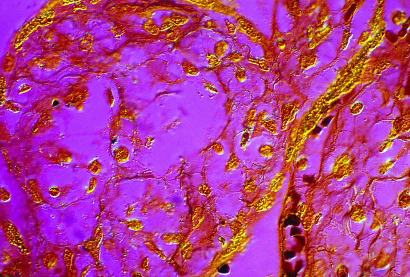 无人,横图,室内,特写,白天,正面,微距,神秘,仪器,微生物,阴影,检查,反射,分析,科学,医学,纹路,纹理,细胞,显微镜,影子,紫色,观察,清晰,探索,放大,观看,仔细,透镜,性传播疾病,疾病,生物学,优美,凸透镜,聚焦,庄重,高贵,关注,消极,胎盘,肌理,光学,清楚,传染,梅毒,梅毒螺旋体,性病,冷色,显微图片,孤寂,彩图,微距摄影,奢华