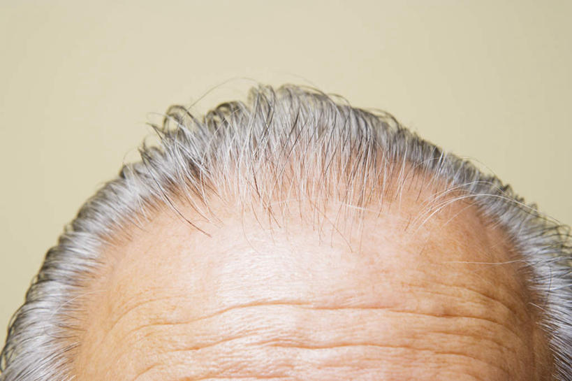 东方人,头发,一个人,横图,室内,特写,白天,正面,亚洲,仅一个男性,仅一个人,黄种人,仅一个老年男性,头顶,老年男性,男人,男性,亚洲人,额头,半身,彩图