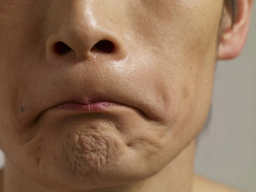 东方人,脸,头,鼻子,嘴,耳朵,脸颊,一个人,横图,室内,特写,白天,正面,亚洲,仅一个男性,仅一个人,灰色背景,黄种人,仅一个年轻男性,嘟嘴,撅嘴,摄影,影棚,抿嘴,男人,男性,年轻男性,亚洲人,头部,鼻,鼻孔,耳,耳部,口,口腔,脸部,脸蛋,面部,嘴巴,嘴唇,半身,彩图,影棚拍摄,拍摄