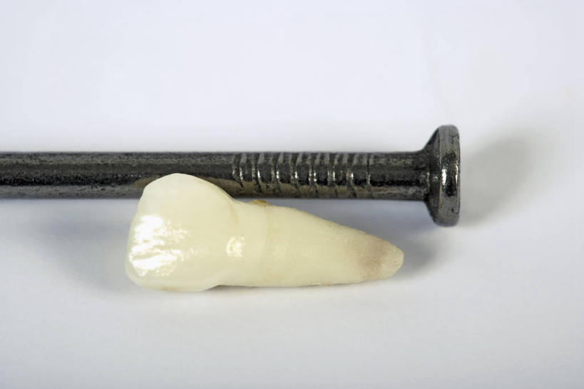 牙齿,无人,横图,室内,特写,白天,白色背景,正面,静物,阴影,反射,钉子,影子,两个,摄影,影棚,五金,紧固,牢固,齿,牙,牙龈,彩图,影棚拍摄,拍摄,稳固