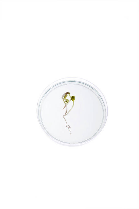 无人,竖图,俯视,室内,特写,白天,白色背景,实验,仪器,微生物,研究,透明,分析,化学,细菌,测试,培养皿,一个,器皿,生物,摄影,影棚,单个,皮氏培养皿,试验耗材,实验用品,化学器材,生命体,通明,彩图,高角度拍摄,影棚拍摄,拍摄,原核生物