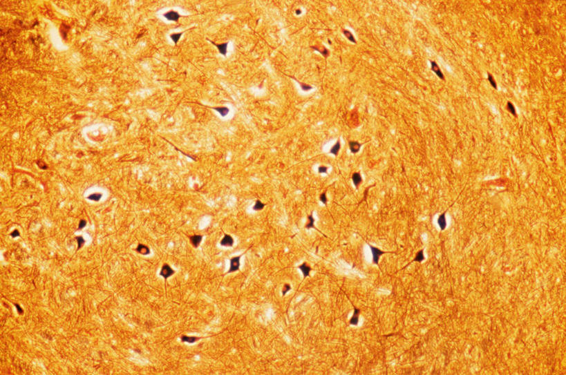 无人,横图,俯视,室内,特写,白天,仪器,微生物,检查,反射,分析,科学,医学,细胞,显微镜,黄色,观察,清晰,探索,放大,观看,仔细,透镜,生物学,凸透镜,聚焦,关注,神经元,光学,清楚,神经细胞,彩图,高角度拍摄
