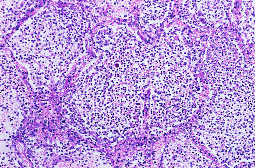 无人,横图,俯视,室内,特写,白天,仪器,微生物,检查,反射,分析,科学,医学,纹路,纹理,细胞,显微镜,紫色,观察,清晰,探索,放大,观看,仔细,透镜,生物学,凸透镜,聚焦,关注,神经元,肌理,光学,清楚,神经细胞,彩图,高角度拍摄