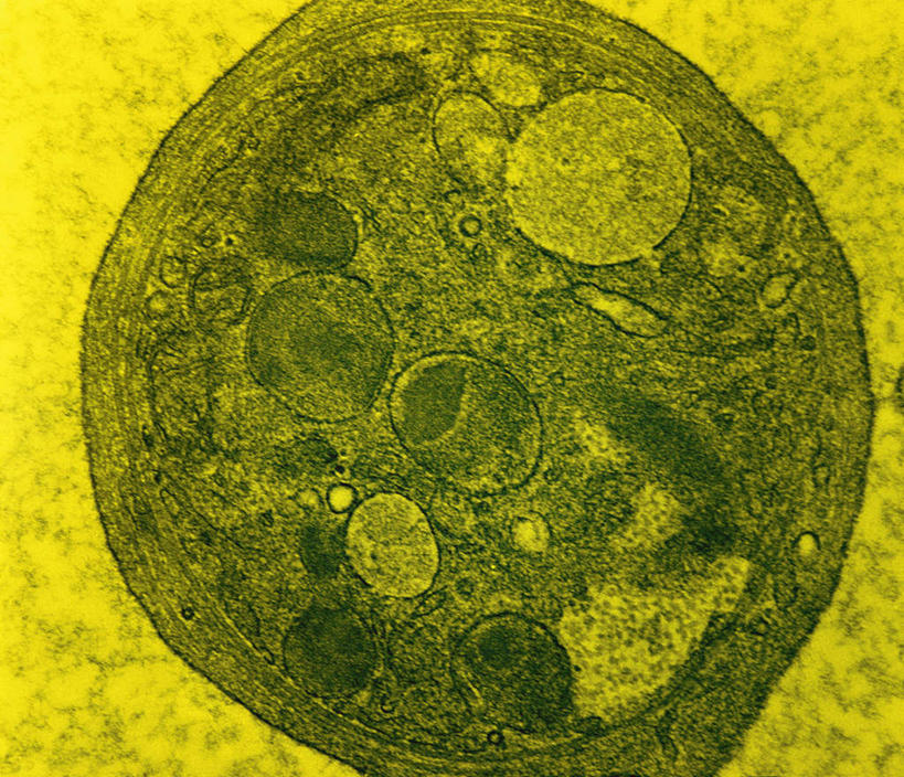 无人,横图,俯视,室内,特写,白天,仪器,静物,检查,反射,分析,科学,红血球,医学,纹路,纹理,细胞,显微镜,黄色,观察,清晰,探索,人体,放大,观看,仔细,透镜,生物学,血细胞,凸透镜,聚焦,关注,生理学,肌理,光学,清楚,红细胞,彩图,高角度拍摄