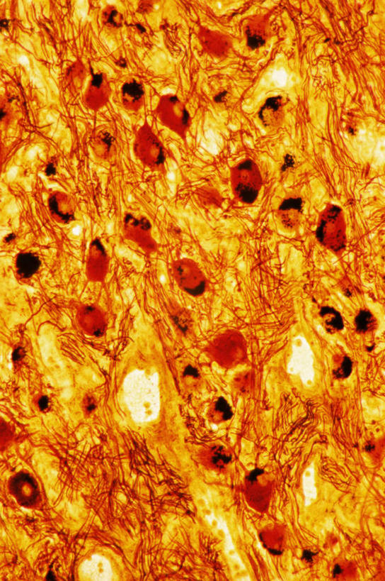 无人,竖图,俯视,室内,特写,白天,仪器,微生物,检查,反射,分析,科学,医学,纹路,纹理,细胞,显微镜,观察,橙色,清晰,探索,放大,观看,仔细,透镜,生物学,凸透镜,聚焦,关注,神经元,肌理,光学,清楚,神经细胞,彩图,高角度拍摄