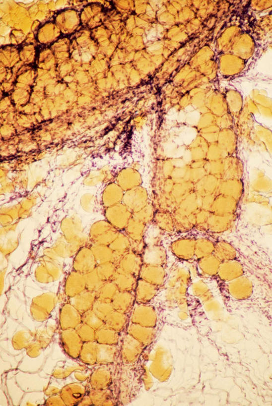 无人,竖图,俯视,室内,特写,白天,仪器,静物,检查,反射,分析,科学,红血球,医学,纹路,纹理,细胞,显微镜,黄色,观察,清晰,探索,人体,放大,观看,仔细,透镜,生物学,血细胞,凸透镜,聚焦,关注,生理学,肌理,光学,清楚,红细胞,彩图,高角度拍摄