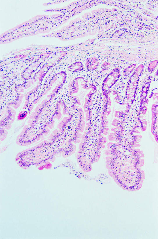 无人,竖图,俯视,室内,特写,白天,仪器,微生物,检查,反射,分析,科学,医学,纹路,纹理,细胞,显微镜,紫色,观察,粘液,清晰,探索,放大,观看,仔细,透镜,生物学,凸透镜,聚焦,关注,黏液,神经元,肌理,光学,清楚,神经细胞,小肠,彩图,高角度拍摄
