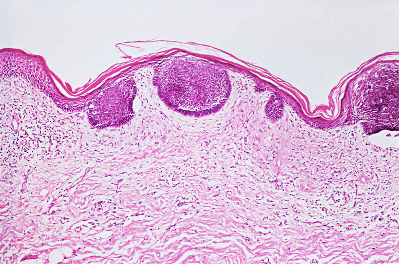 无人,横图,俯视,室内,特写,白天,仪器,微生物,检查,反射,分析,科学,医学,纹路,纹理,细胞,显微镜,紫色,观察,清晰,探索,放大,观看,仔细,透镜,生物学,凸透镜,聚焦,关注,肿瘤,癌症,神经元,肌理,光学,清楚,神经细胞,恶性肿瘤,皮肤癌,彩图,高角度拍摄,黑素瘤