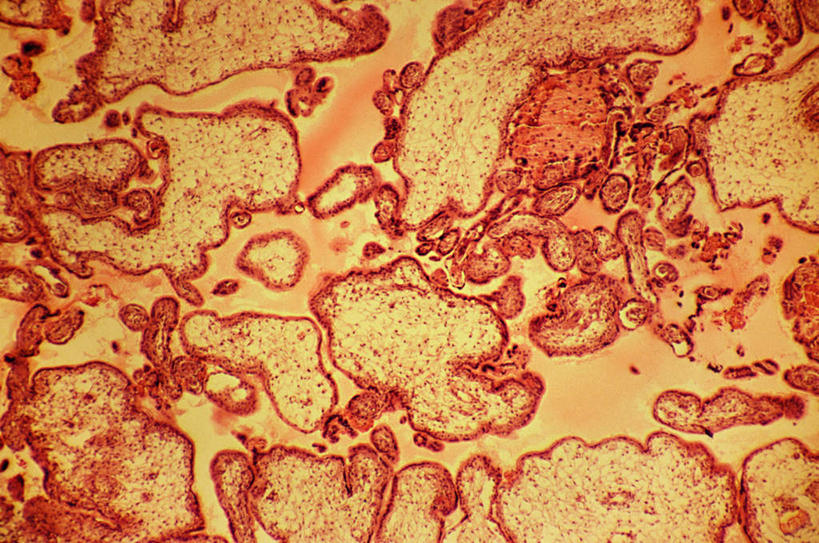 内脏,动脉,静脉,子宫,无人,横图,俯视,室内,特写,白天,仪器,静物,检查,反射,分析,科学,医学,纹路,纹理,显微镜,黄色,红色,模型,观察,清晰,探索,人体,放大,观看,仔细,透镜,生物学,人体器官,凸透镜,聚焦,器官,关注,胎盘,生理学,肌理,光学,清楚,彩图,高角度拍摄