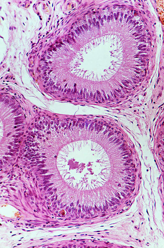 膀胱,睾丸,阴囊,尿道,无人,竖图,俯视,室内,特写,白天,仪器,微生物,检查,反射,分析,科学,医学,纹路,纹理,细胞,显微镜,紫色,观察,清晰,探索,放大,观看,仔细,透镜,生物学,凸透镜,聚焦,关注,泌尿系统,前列腺,神经元,肌理,光学,清楚,附睾,神经细胞,内生殖器,排泄器官,外生殖器,输精管,精囊腺,尿道球腺,射精管,彩图,高角度拍摄,男性生殖系统,生殖器官