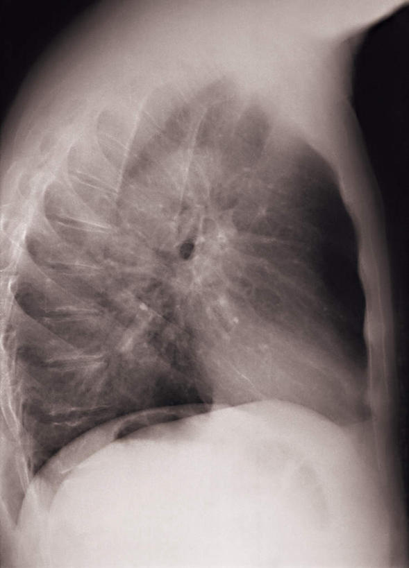 内脏,动脉,静脉,无人,竖图,x光片,室内,特写,白天,正面,静物,辐射,科学,医学,模型,人体,医疗,生物学,人体器官,科学技术,x射线,器官,x光,生理学,彩图,电磁波,电磁辐射