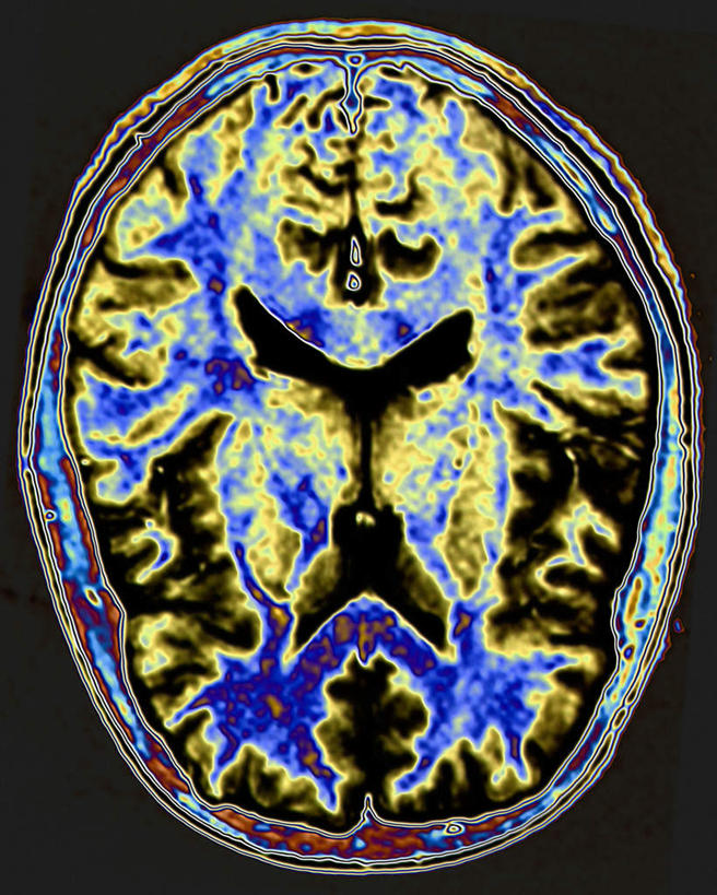 内脏,肾脏,动脉,静脉,膀胱,无人,竖图,x光片,室内,特写,白天,正面,静物,黑色背景,辐射,科学,医学,模型,人体,医疗,生物学,人体器官,科学技术,x射线,器官,x光,生理学,肾,彩图,电磁波,电磁辐射