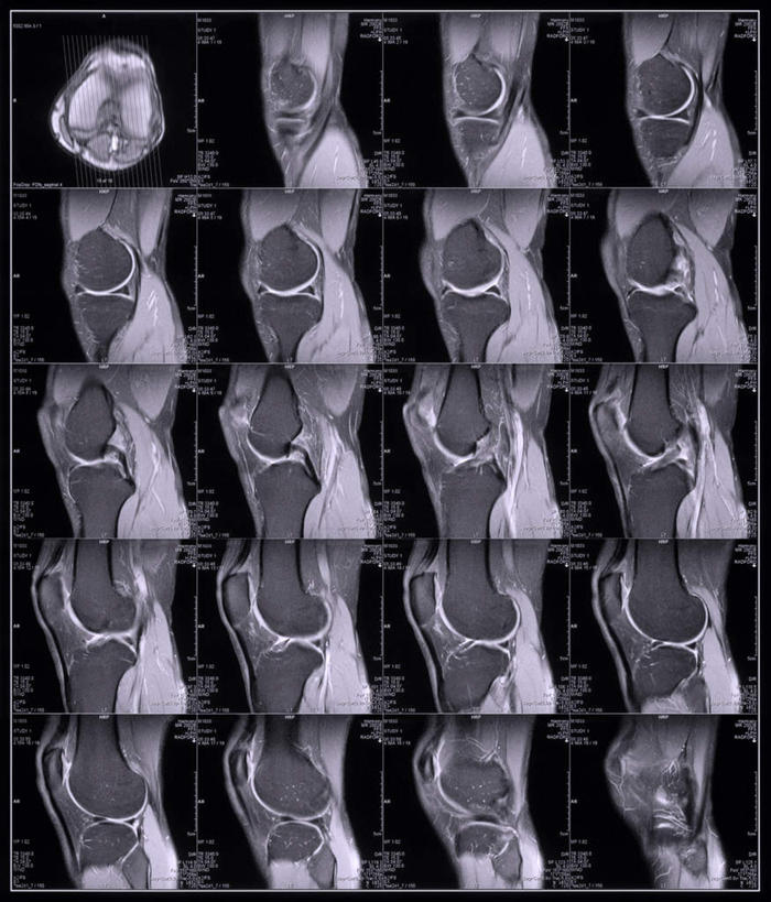 骨骼,无人,竖图,x光片,室内,特写,白天,正面,静物,一排,许多,黑色背景,整齐,辐射,科学,医学,骨头,排列,骨架,医疗,科学技术,x射线,队列,x光,髌骨,腓骨,股骨,胫骨,彩图,电磁波,电磁辐射