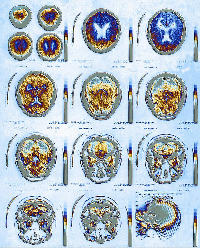 无人,竖图,室内,特写,白天,正面,机器,静物,大脑,一排,整齐,并列,并排,医学,设备,排列,医疗,器官,队列,沟壑,核磁共振,平行,核磁共振成像,小脑,脑干,大脑皮层,端脑,沟,灰质,回,间脑,磁共振成像,核磁共振技术,彩图