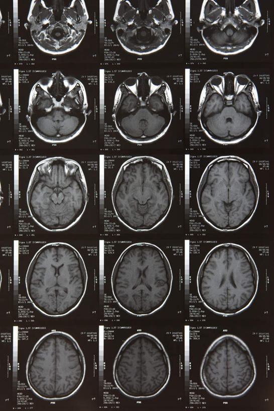 脑,无人,竖图,x光片,室内,特写,白天,正面,静物,一排,许多,整齐,辐射,科学,医学,排列,医疗,科学技术,x射线,队列,x光,脑部,脑子,彩图,电磁波,电磁辐射