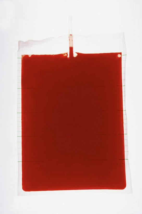 无人,竖图,俯视,室内,特写,白天,白色背景,静物,阴影,反射,影子,一个,红色,血液,摄影,影棚,单个,急救,医疗,提供,输血,抢救,血袋,输血袋,供应,盛放,血液袋,彩图,高角度拍摄,影棚拍摄,拍摄,供给