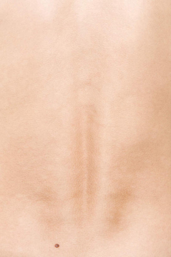 西方人,脊髓,一个人,竖图,室内,特写,白天,欧洲,欧洲人,仅一个年轻女性,仅一个女性,仅一个人,灰色背景,裸露,背面,摄影,影棚,后背,裸,年轻女性,女人,女性,白种人,脊柱,半身,彩图,影棚拍摄,拍摄