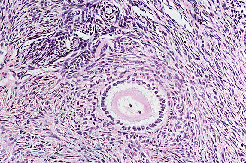 子宫,无人,横图,室内,特写,白天,正面,仪器,微生物,切开,检查,反射,分析,科学,医学,细胞,显微镜,紫色,观察,切,清晰,探索,放大,观看,仔细,透镜,生物学,凸透镜,聚焦,关注,剖面,切面,光学,清楚,显微图片,彩图