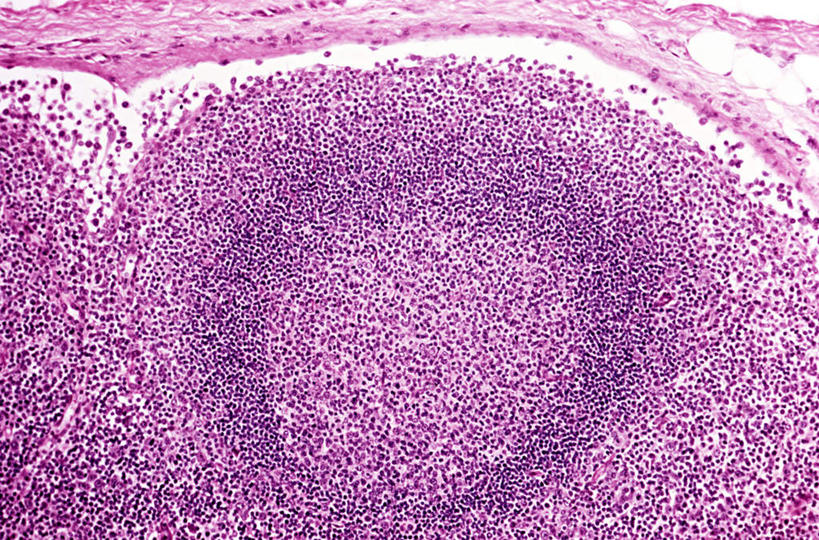 无人,横图,室内,特写,白天,正面,微生物,阴影,反射,科学,医学,纹路,纹理,细胞,影子,紫色,生物学,肌理,淋巴系统,淋巴细胞,淋巴,淋巴管,淋巴液,淋巴组织,免疫系统,免疫组织,显微图片,彩图