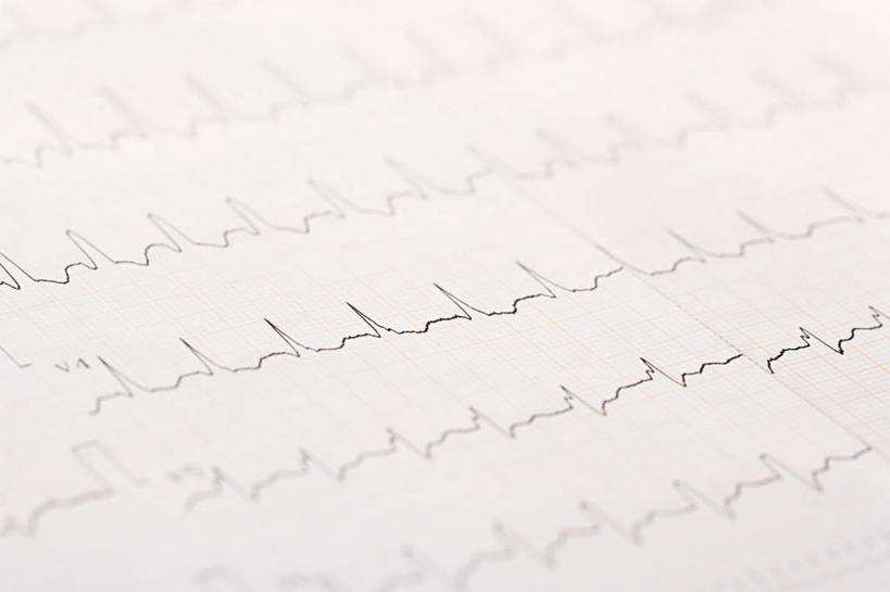 无人,横图,俯视,室内,特写,白天,静物,朦胧,模糊,科学,医学,材料,档案,文件,线条,心电图,纸,手稿,资料,证明,医疗,科学技术,文档,彩图,高角度拍摄