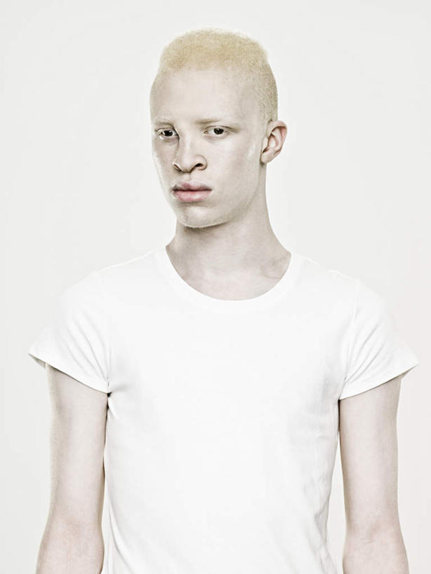 西方人,一个人,站,竖图,室内,白天,白色背景,正面,欧洲,非洲,黑人,欧洲人,仅一个男性,仅一个人,服装,注视,休闲装,仅一个年轻男性,衣服,白色,观察,看,站着,休闲,生病,休闲服,摄影,服饰,影棚,观看,察看,关注,抱病,白化病,男人,男性,年轻男性,非洲人,站立,半身,彩图,影棚拍摄,拍摄