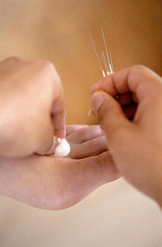 西方人,手,腿部,脚,脚趾,脚趾甲,腿,两个人,医生,躺,竖图,俯视,室内,特写,白天,农作物,欧洲,欧洲人,双手,握,阴影,朦胧,模糊,柔软,反射,医学,影子,棉花,拿,拿着,光脚,文化,纺织,医护人员,医疗人员,健康,温暖,赤脚,手部,棉花球,治疗,握着,保健,经络,纤维,医疗,穴位,中国文化,针灸,调和,中医,医治,柔和,疏通,暖和,灸法,针法,中医学,卧着,男人,男性,女人,女性,中年男性,中年女性,白种人,脚指甲,大夫,躺着,卧,半身,彩图,高角度拍摄,传统文化