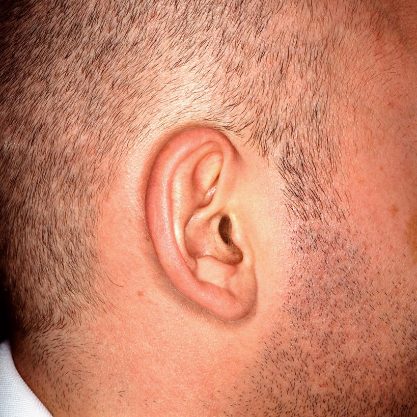 西方人,头,耳朵,一个人,方图,室外,特写,白天,侧面,欧洲,欧洲人,仅一个男性,仅一个人,仅一个中年男性,男人,男性,中年男性,白种人,头部,耳,耳部,半身,彩图