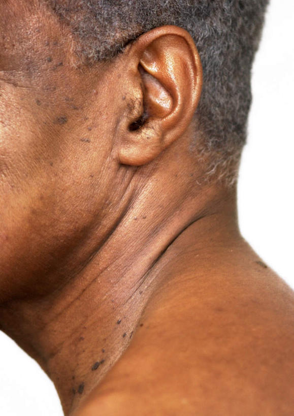 西方人,耳朵,脑,一个人,站,竖图,室内,特写,白天,白色背景,侧面,欧洲,欧洲人,仅一个男性,仅一个人,站着,仅一个老年男性,摄影,影棚,老年男性,男人,男性,白种人,脑部,脑子,耳,耳部,站立,半身,彩图,影棚拍摄,拍摄