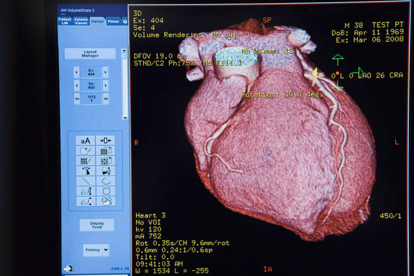 无人,医生,医院,横图,室内,白天,正面,显示器,检查,工具,屏幕,显示屏,扫描仪,器械,检测,医疗,医疗器械,医疗工具,输出设备,医疗机构,计算机断层扫描,ct机,扫描仪器,显像机,彩图,病院,诊所