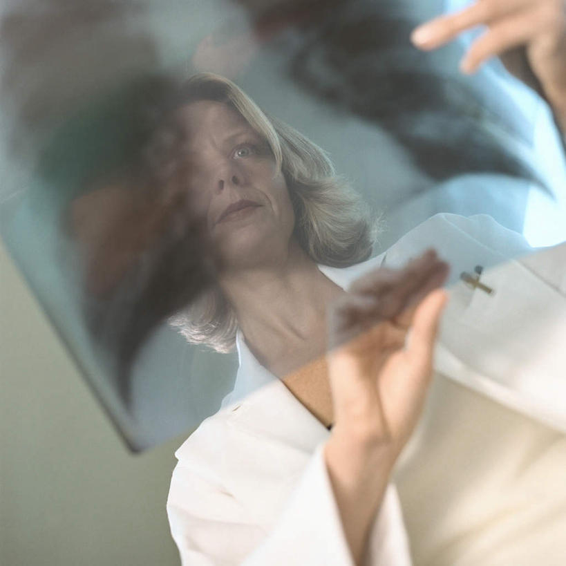 西方人,脸,头,脸颊,一个人,医生,办公室,医院,方图,x光片,室内,白天,仰视,仪器,欧洲,欧洲人,仅一个女性,仅一个人,两张,握,挂,拿,拿着,注视,观察,看,仅一个中年女性,医护人员,医疗人员,思考,想,握着,遮,遮掩,观看,察看,医疗设备,遮挡,挂着,白大褂,关注,医疗器械,医疗仪器,遮盖,医疗机构,观片灯,女人,女性,中年女性,白种人,头部,脸部,脸蛋,面部,大夫,半身,彩图,低角度拍摄,病院,诊所