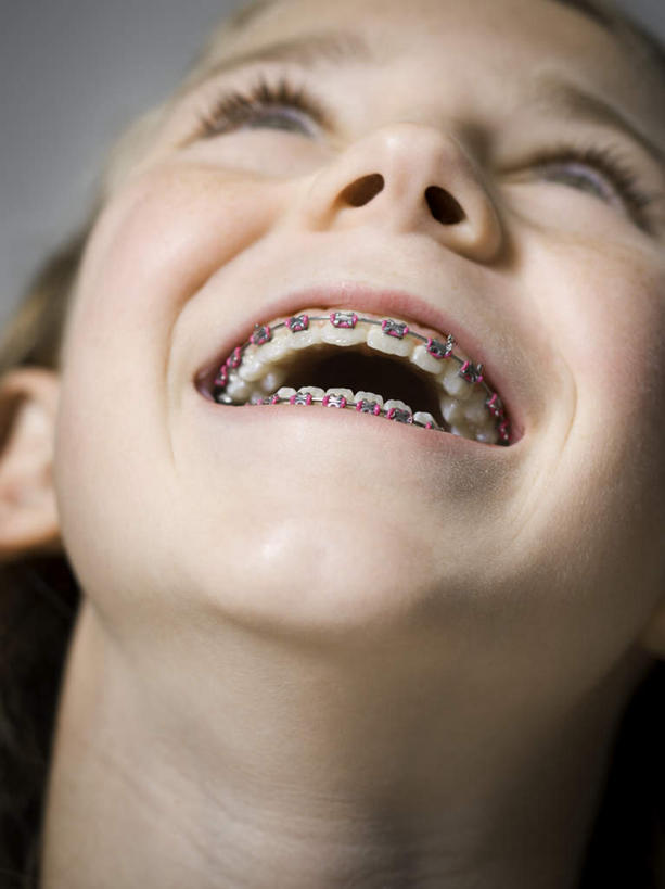 西方人,儿童,脸,头,脸颊,一个人,竖图,室内,特写,白天,正面,纯洁,欧洲,欧洲人,仅一个女性,仅一个人,灰色背景,朦胧,模糊,注视,小孩,模型,观察,看,仅一个小孩,可爱,童年,童趣,摄影,影棚,模具,观看,察看,关注,矫正,牙科,牙套,童真,牙箍,烂漫,无邪,校正,校准,牙饰,天真,女孩,女人,女性,白种人,孩子,头部,脸部,脸蛋,面部,抬头,仰头,半身,彩图,影棚拍摄,拍摄,女生