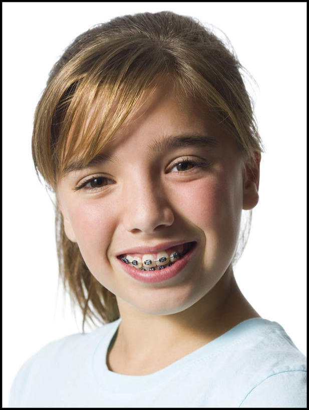 西方人,脸,头,脸颊,头发,一个人,笑,微笑,露齿笑,竖图,室内,特写,白天,白色背景,正面,欧洲,欧洲人,仅一个年轻女性,仅一个女性,仅一个人,服装,棕色,注视,休闲装,肩膀,衣服,白色,模型,观察,看,休闲,休闲服,摄影,服饰,影棚,模具,观看,察看,马尾辫,关注,矫正,牙科,牙套,牙箍,校正,校准,牙饰,年轻女性,女人,女性,白种人,头部,长发,直发,脸部,脸蛋,面部,半身,彩图,影棚拍摄,拍摄