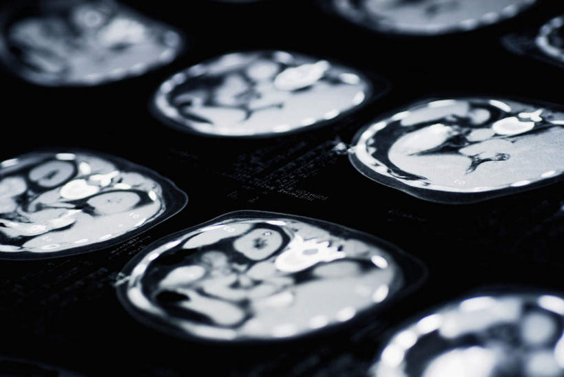 无人,横图,俯视,x光片,室内,特写,白天,机器,静物,黑色背景,朦胧,模糊,辐射,科学,医学,设备,摄影,影棚,医疗,科学技术,x射线,x光,核磁共振,核磁共振成像,磁共振成像,核磁共振技术,彩图,高角度拍摄,影棚拍摄,拍摄,电磁波,电磁辐射