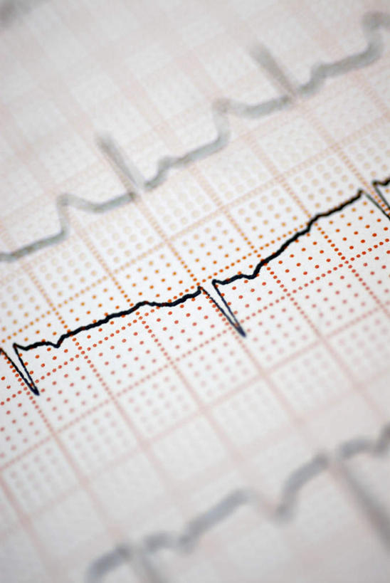 无人,竖图,俯视,室内,特写,白天,静物,起伏,朦胧,模糊,曲折,弯曲,材料,档案,文件,纸,手稿,资料,记录,高低,蜿蜒,证明,文档,脉搏,记载,记实,纪录,彩图,高角度拍摄,脉搏波,病历