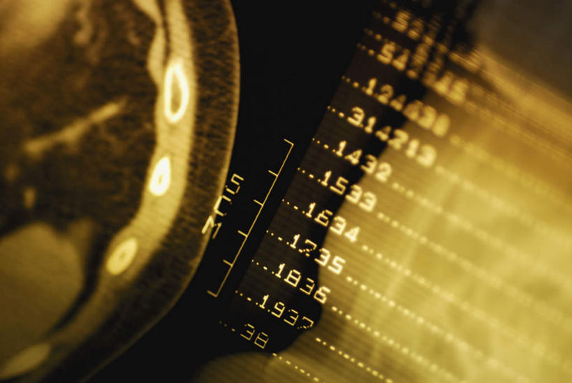 无人,横图,俯视,x光片,室内,特写,白天,机器,静物,朦胧,模糊,辐射,科学,医学,标志,数字,文字,字符,设备,标识,阿拉伯数字,医疗,科学技术,x射线,x光,核磁共振,核磁共振成像,磁共振成像,核磁共振技术,彩图,高角度拍摄,电磁波,电磁辐射