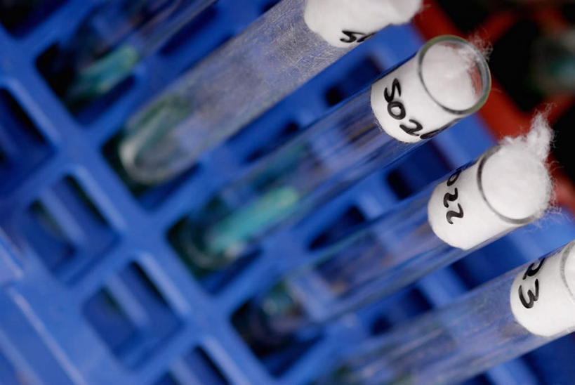 无人,横图,俯视,室内,特写,白天,农作物,实验,仪器,静物,杯子,一排,阴影,朦胧,模糊,柔软,研究,整齐,透明,反射,分析,化学,测试,标志,试管,试管架,数字,文字,影子,字符,棉花,标识,架子,玻璃制品,纺织,排列,玻璃瓶,瓶子,健康,温暖,器皿,杀菌,阿拉伯数字,纤维,消毒,队列,计量,玻璃仪器,试验耗材,实验用品,酒精棉,柔和,暖和,玻璃杯,彩图,高角度拍摄,乙醇