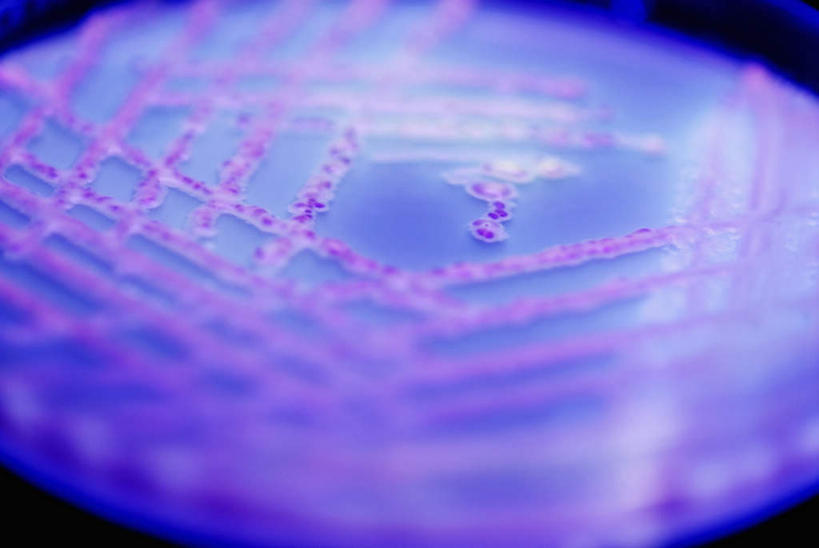 无人,横图,俯视,室内,特写,白天,实验,仪器,微生物,阴影,朦胧,模糊,研究,反射,分析,化学,细菌,测试,纹路,培养皿,纹理,影子,器皿,生物,皮氏培养皿,试验耗材,实验用品,化学器材,肌理,生命体,彩图,高角度拍摄,原核生物