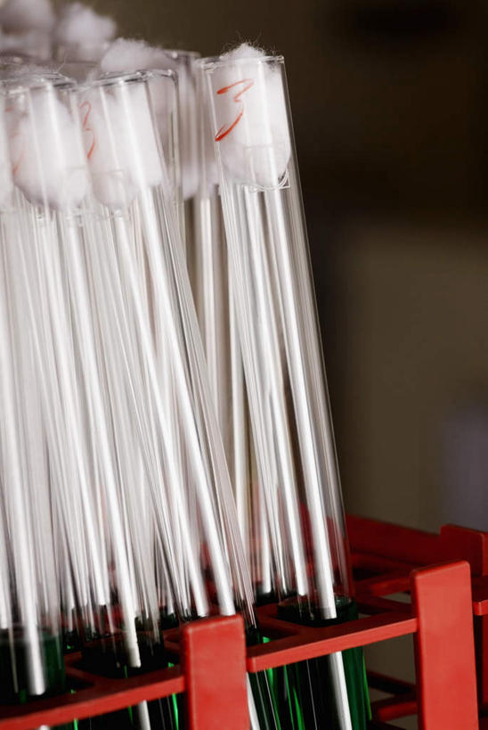 无人,竖图,室内,特写,白天,正面,农作物,实验,仪器,静物,杯子,阴影,朦胧,模糊,柔软,研究,透明,反射,分析,化学,测试,试管,试管架,影子,棉花,架子,玻璃制品,纺织,玻璃瓶,瓶子,健康,温暖,器皿,杀菌,纤维,消毒,计量,玻璃仪器,试验耗材,实验用品,酒精棉,柔和,暖和,玻璃杯,彩图,乙醇