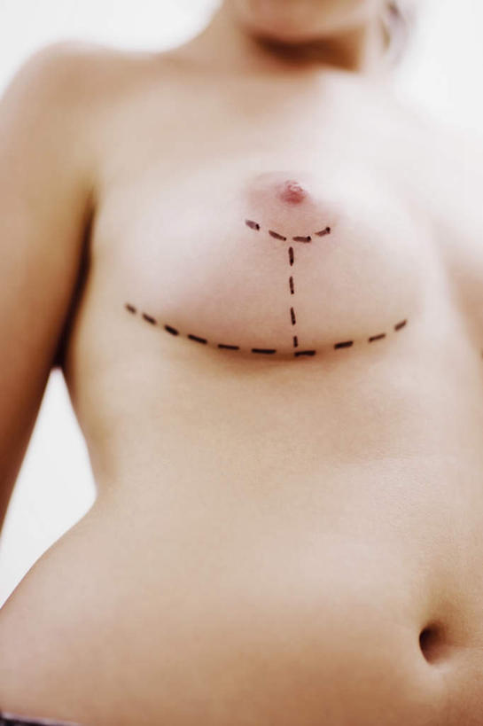 西方人,胸,一个人,站,竖图,室内,特写,白天,白色背景,仰视,欧洲,欧洲人,仅一个年轻女性,仅一个女性,仅一个人,一排,阴影,朦胧,模糊,整齐,环绕,围绕,反射,线条,影子,环抱,裸露,排列,黑色,站着,摄影,影棚,手术,队列,裸,整形,隆胸,萦绕,年轻女性,女人,女性,白种人,胸部,站立,半身,彩图,低角度拍摄,影棚拍摄,拍摄,外科手术,医疗美容外科手术,整形手术