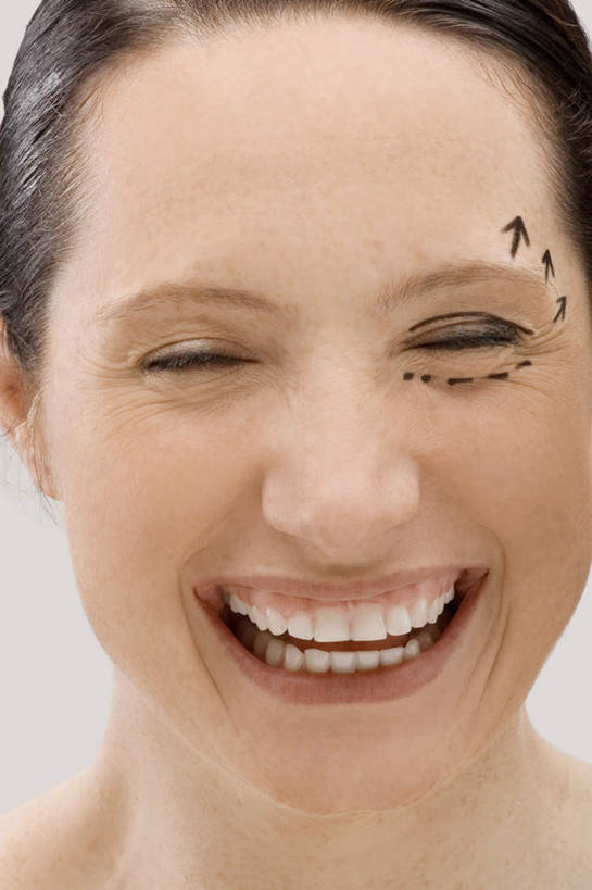 西方人,脸,头,眼睛,脸颊,眉毛,睫毛,一个人,笑,微笑,露齿笑,竖图,室内,特写,白天,白色背景,正面,欧洲,欧洲人,瞳孔,仅一个年轻女性,仅一个女性,仅一个人,注视,方向,标记,箭头,黑色,观察,看,眼部,摄影,影棚,观看,察看,手术,指向,关注,整形,簇,年轻女性,女人,女性,白种人,头部,睫,脸部,脸蛋,眉,面部,眼,眼睫毛,眼眉,半身,彩图,影棚拍摄,拍摄,外科手术,医疗美容外科手术,整形手术,眼眉毛