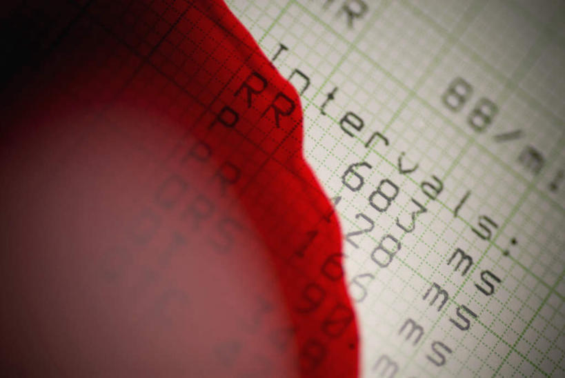 无人,横图,俯视,室内,特写,白天,静物,一排,许多,阴影,整齐,反射,科学,医学,英文,标志,文字,线条,影子,字符,字母,标识,排列,红色,血液,英文字母,医疗,科学技术,队列,阿拉伯文,波动,阿拉伯语,阿拉伯字母,彩图,高角度拍摄,脉搏波