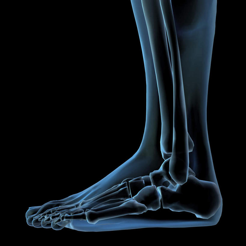 西方人,腿部,骨骼,腿,一个人,无人,方图,插画,x光片,室内,特写,白天,正面,数码,科技,欧洲,欧洲人,仅一个男性,仅一个人,阴影,黑色背景,辐射,科学,网络,医学,骨头,高光,几何,计算机图形,合成,图画,画,仅一个年轻男性,电脑合成图,数码合成图,骨架,医疗,科学技术,x射线,合成图,x光,漫画,写实,具体,具象,髌骨,腓骨,跗骨,股骨,胫骨,趾骨,蹠骨,男人,男性,年轻男性,白种人,半身,彩图,电磁波,电磁辐射