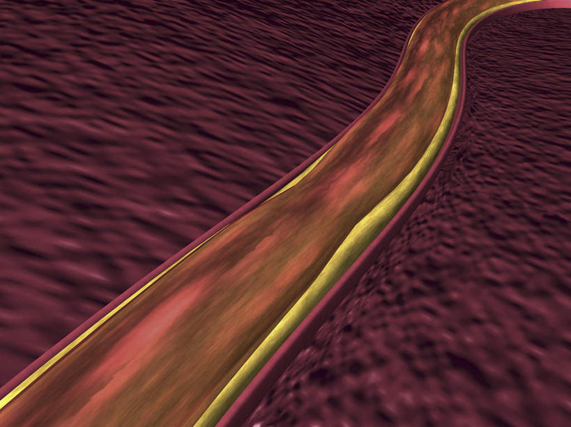 内脏,动脉,静脉,血管,无人,横图,插画,室内,白天,正面,兴奋,热情,数码,科技,静物,阴影,网络,医学,高光,几何,计算机图形,开放,合成,图画,画,红色,模型,健康,温暖,血液,奔放,活力,积极,激情,人体,朝气,暖色,吉祥,电脑合成图,数码合成图,生物学,人体器官,生命,器官,合成图,漫画,饱满,生理学,写实,具体,具象,革命,胆固醇,热烈,赤色,充实,斗志,喜气,主动,彩图,欢乐