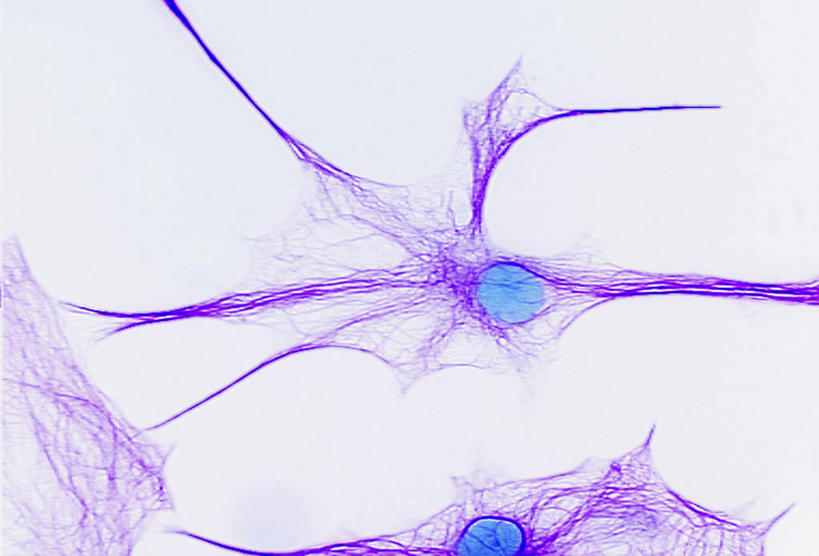 无人,横图,插画,室内,白天,白色背景,正面,数码,科技,微生物,阴影,科学,网络,医学,细胞,高光,几何,计算机图形,合成,图画,画,电脑合成图,数码合成图,生物学,合成图,漫画,神经元,写实,具体,具象,神经细胞,彩图